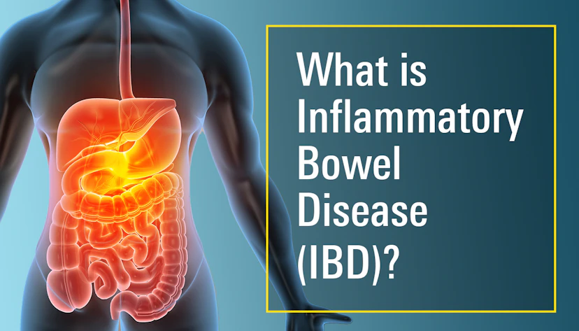 Inflammatory Bowel Disease