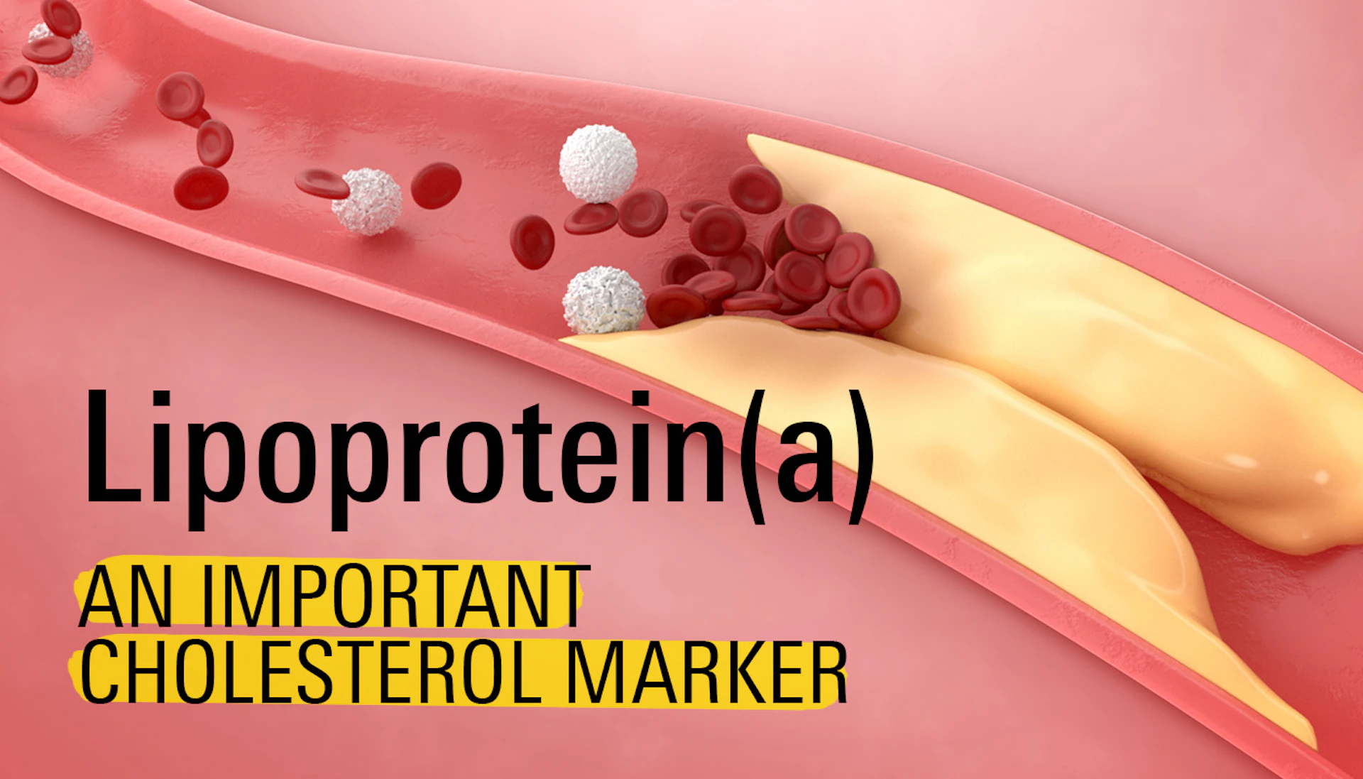 Lipoprotein A