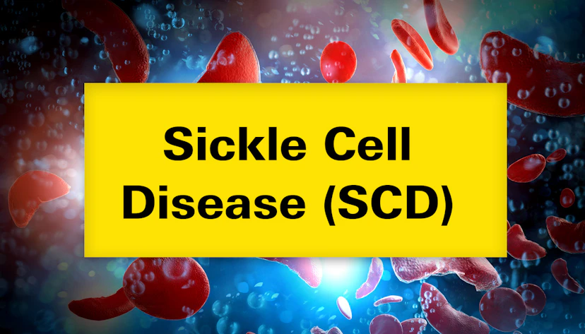 Sickle Cell Disease