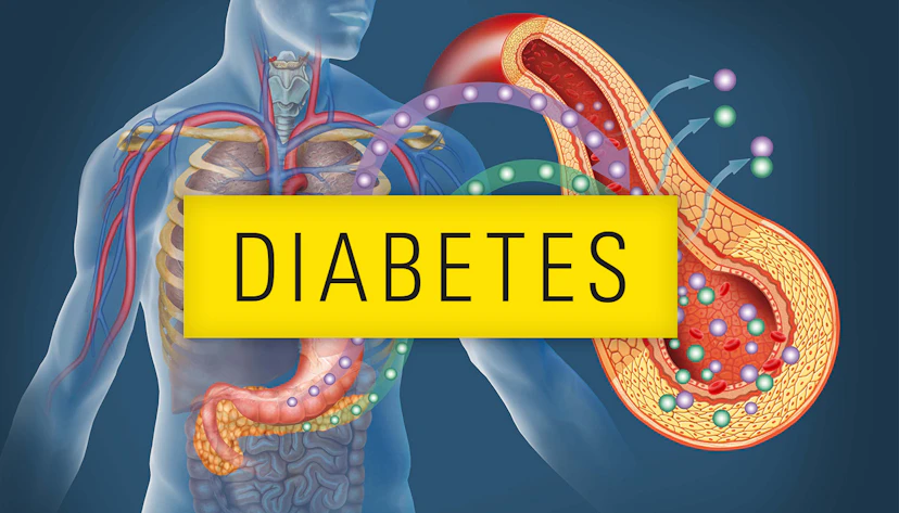 Bl Diabetes