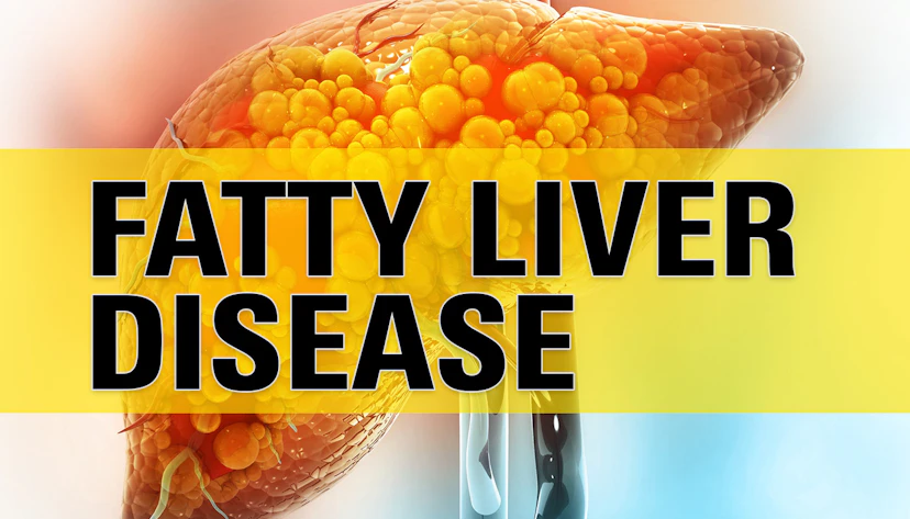 Fatty Liver Disease