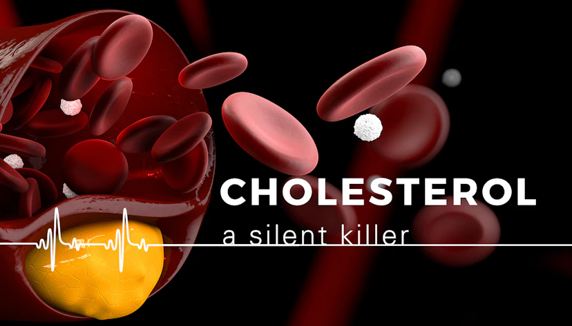 Cholesterol Management