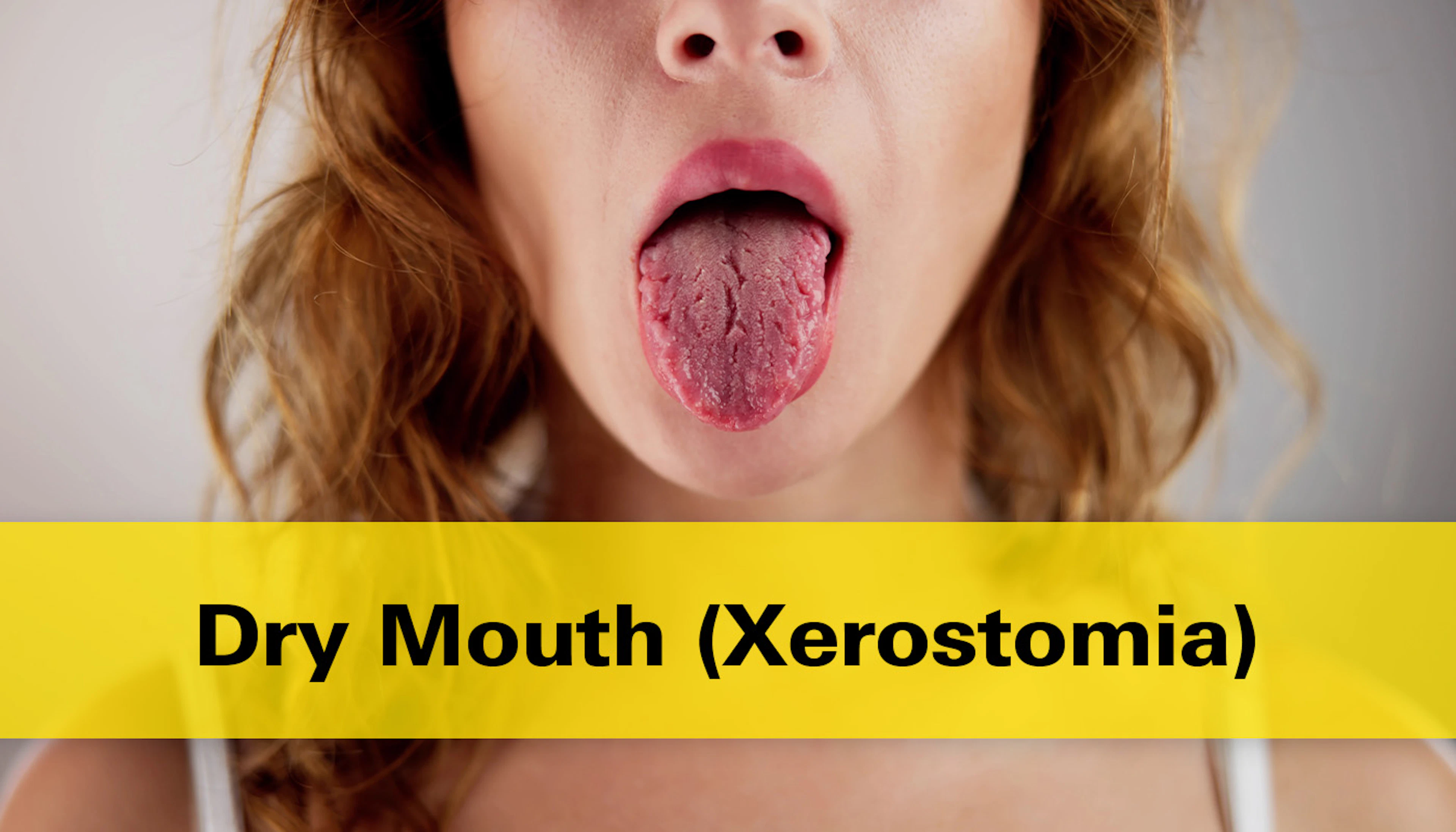 Dry Mouth