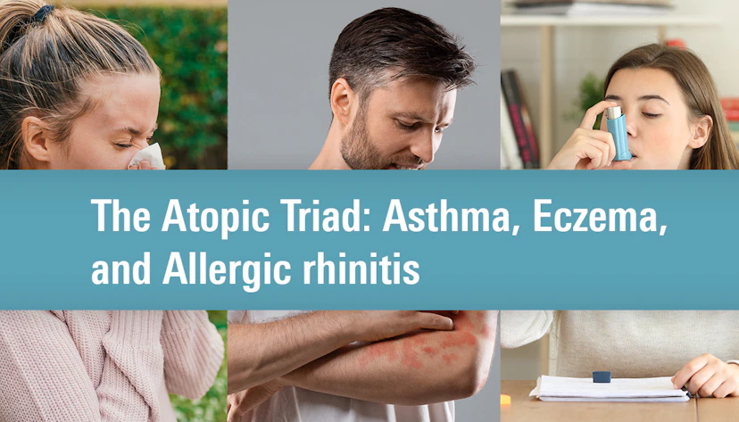 Atopic Triad