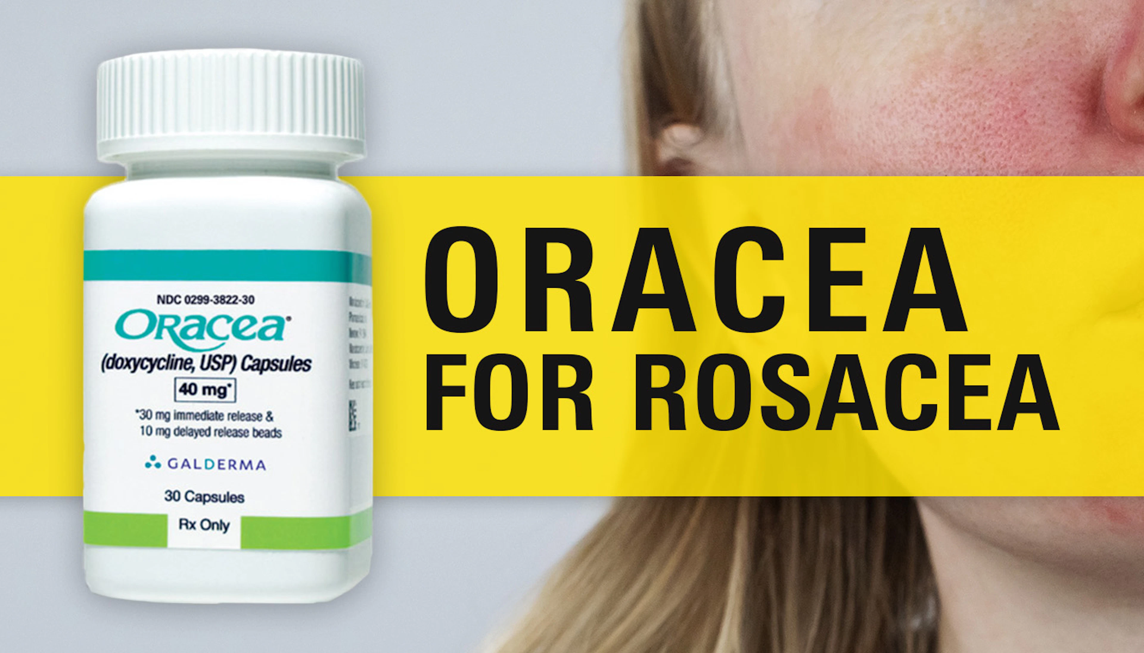 Oraces For Rosacea