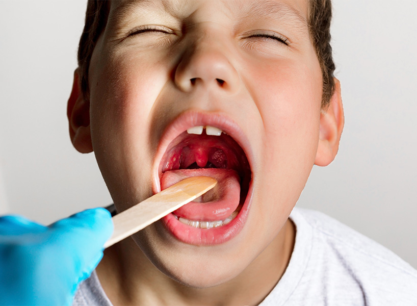 Tonsils