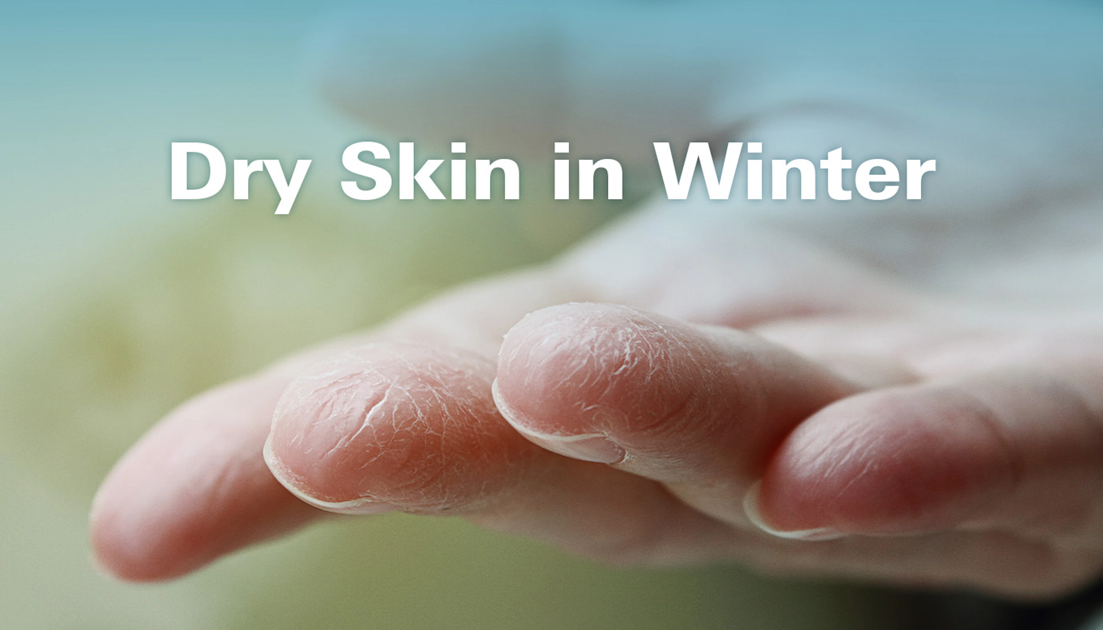 Winter Dry Skin