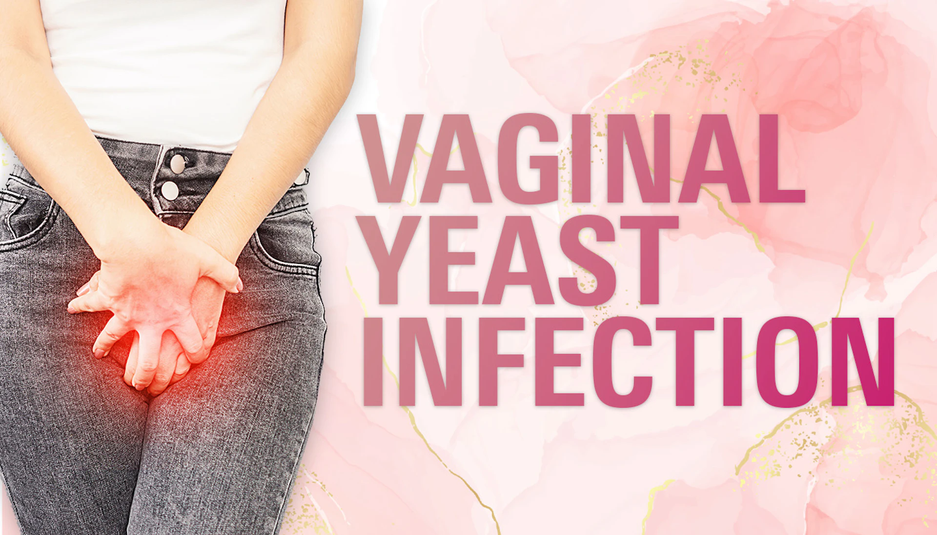 Yeast Infection