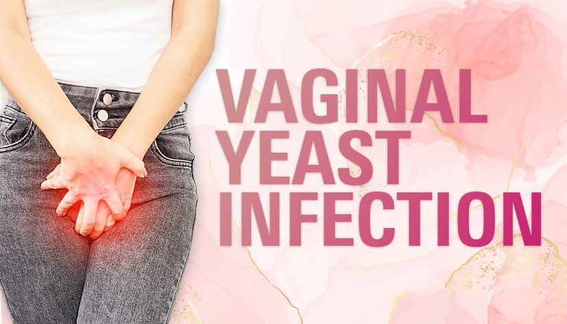 Yeast Infection