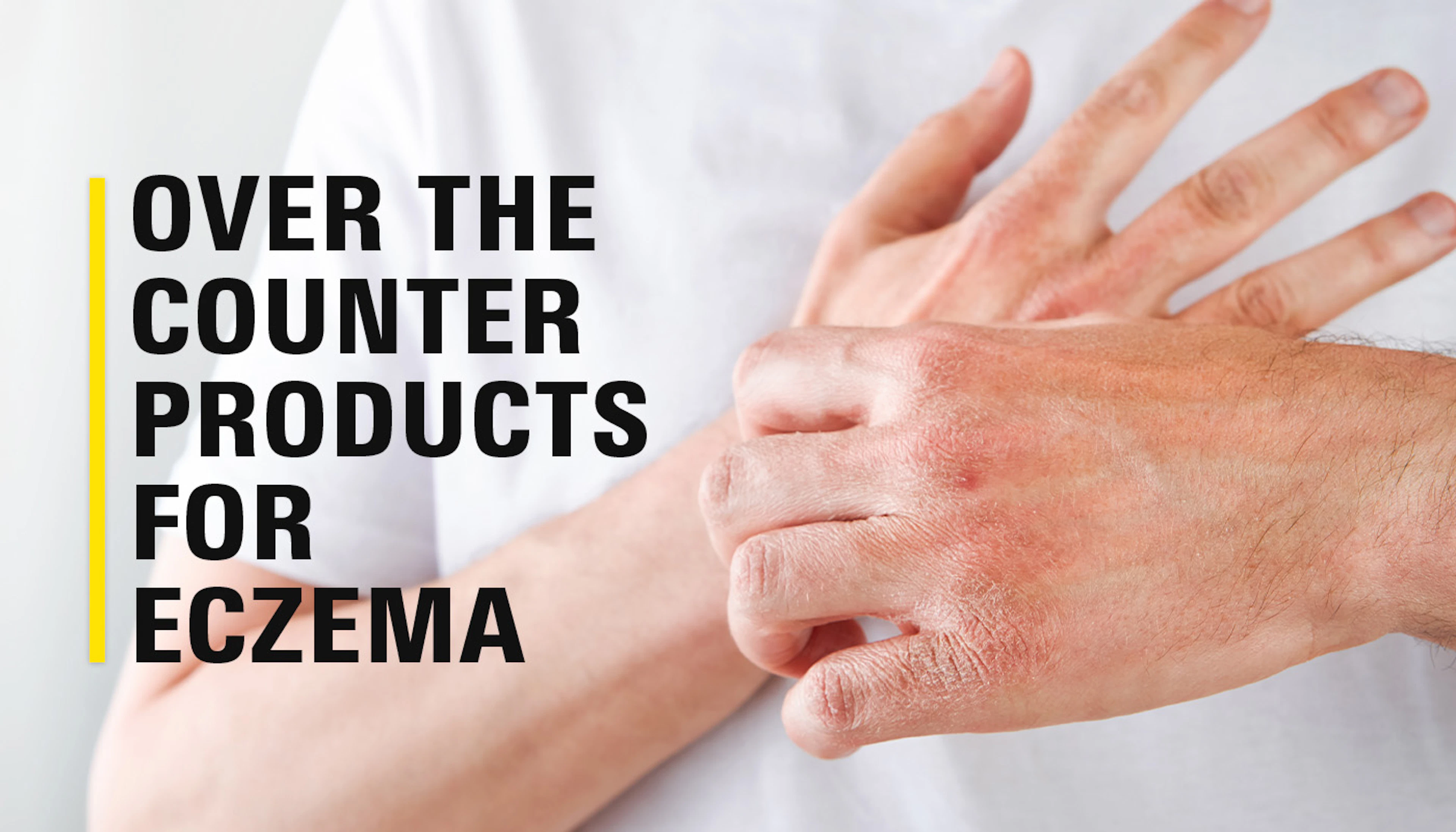 Top OTC Products For Eczema