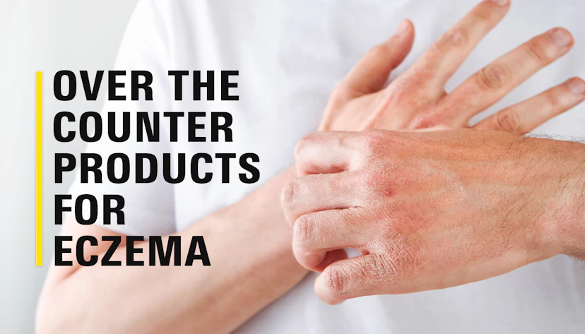 Top OTC Products For Eczema