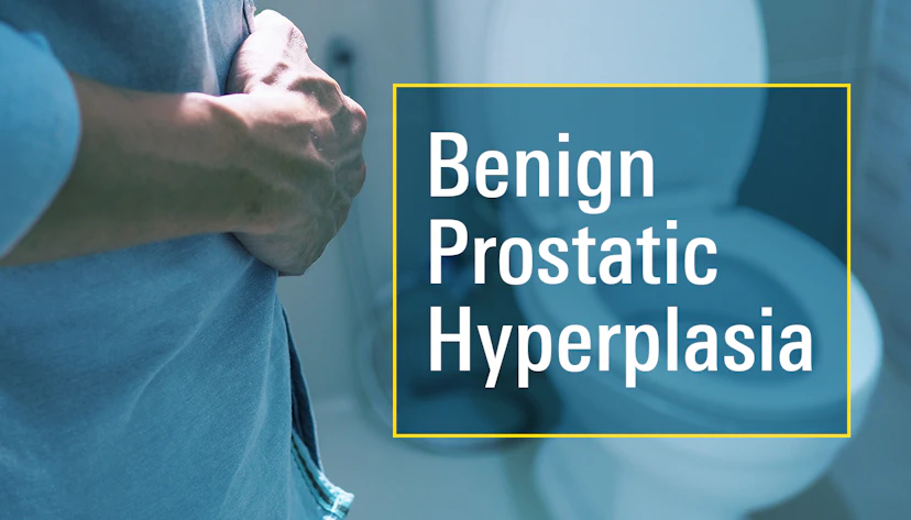 Benign Prostate Hyperplasia