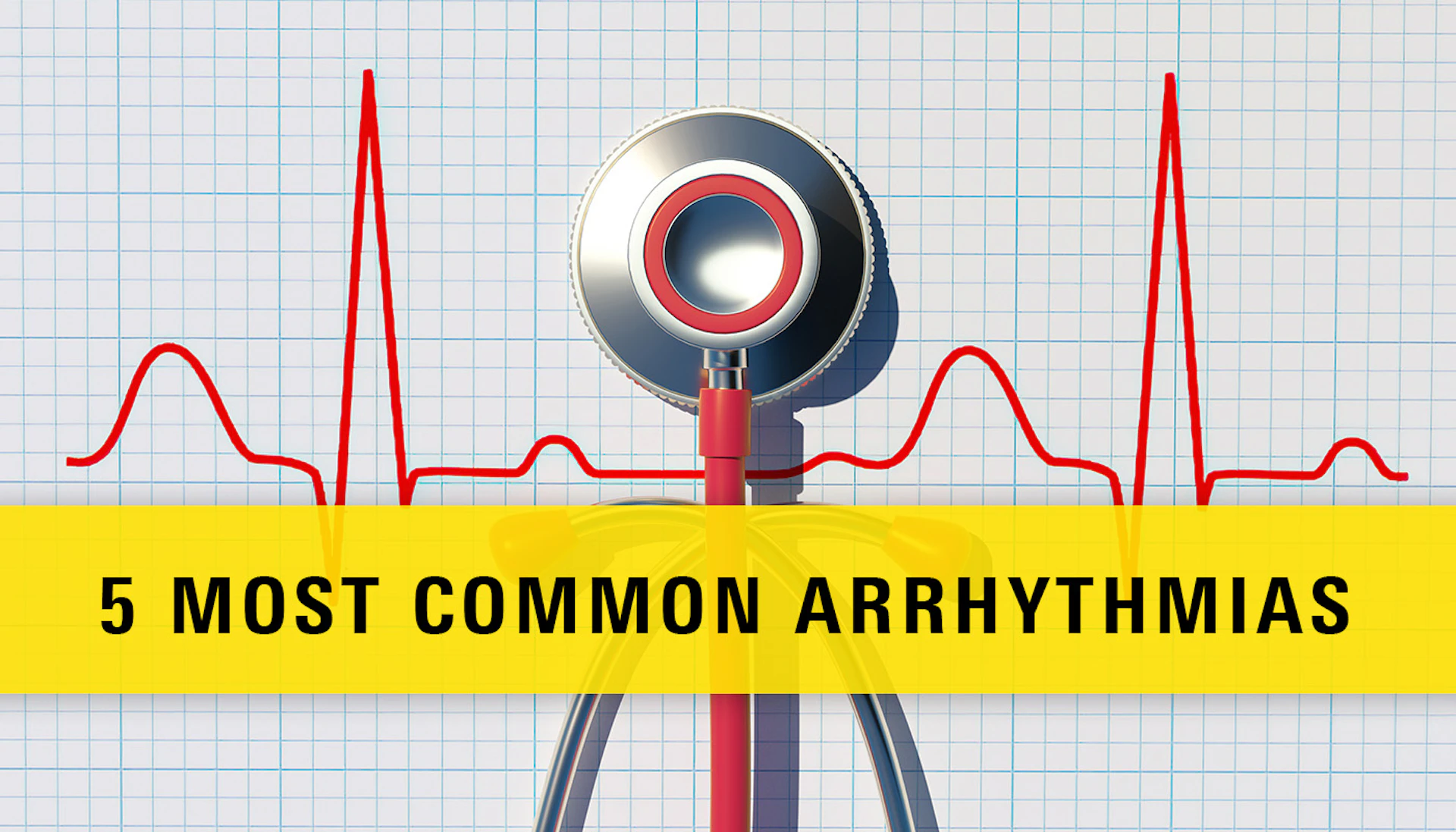 Arrhythmias