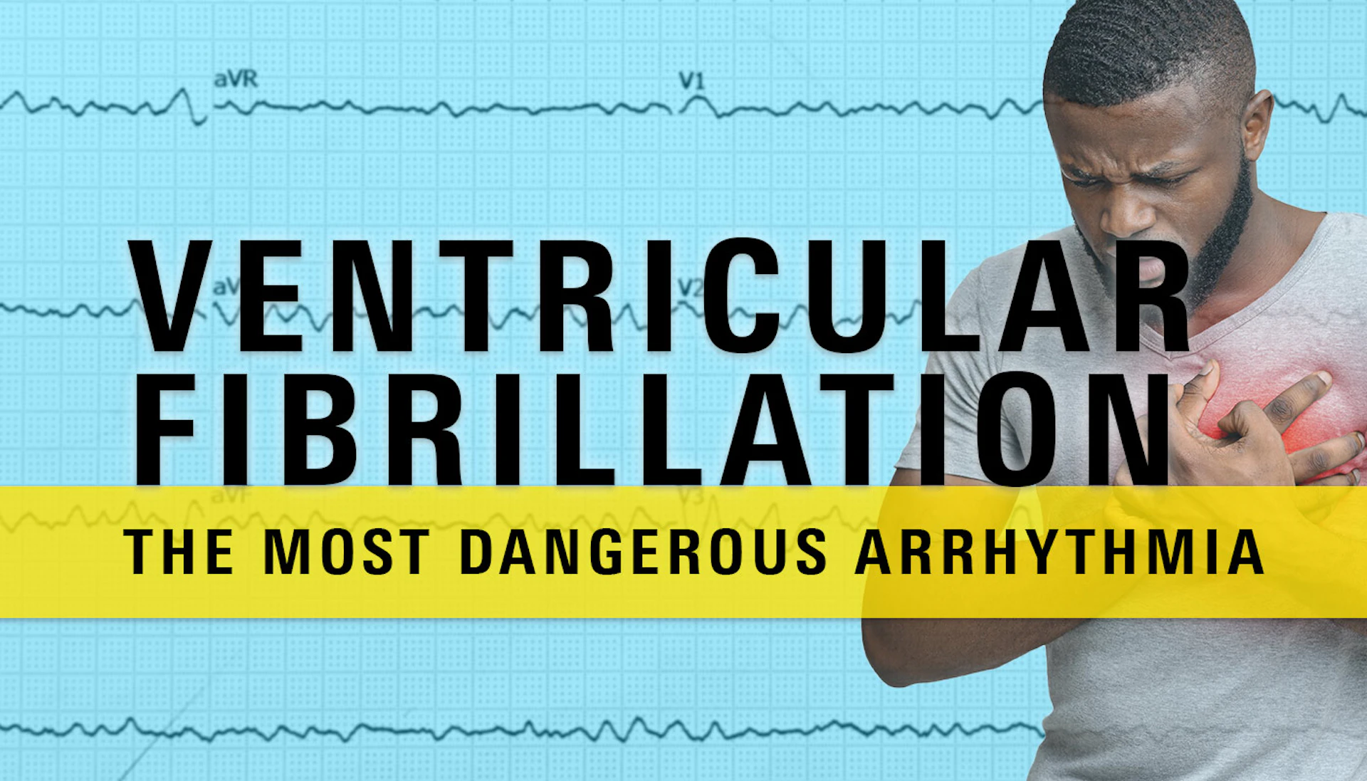 Ventricular Fibrillation