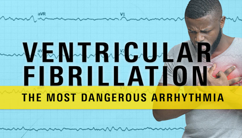 Ventricular Fibrillation