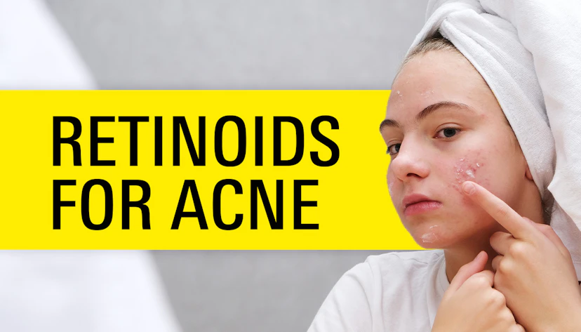 Bl Acne Retinoids