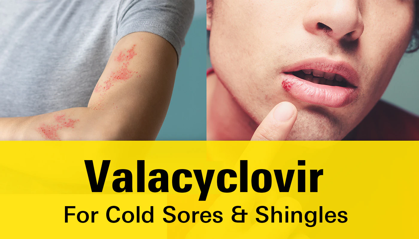 Valacyclovir For Cold Sores - Uses, Side Effects, And Cost