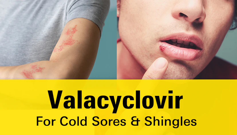 Valacyclovir
