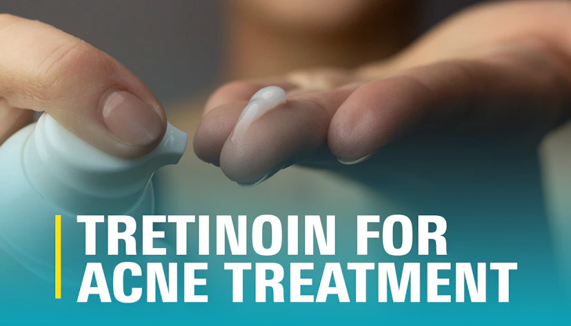 Tretinoin