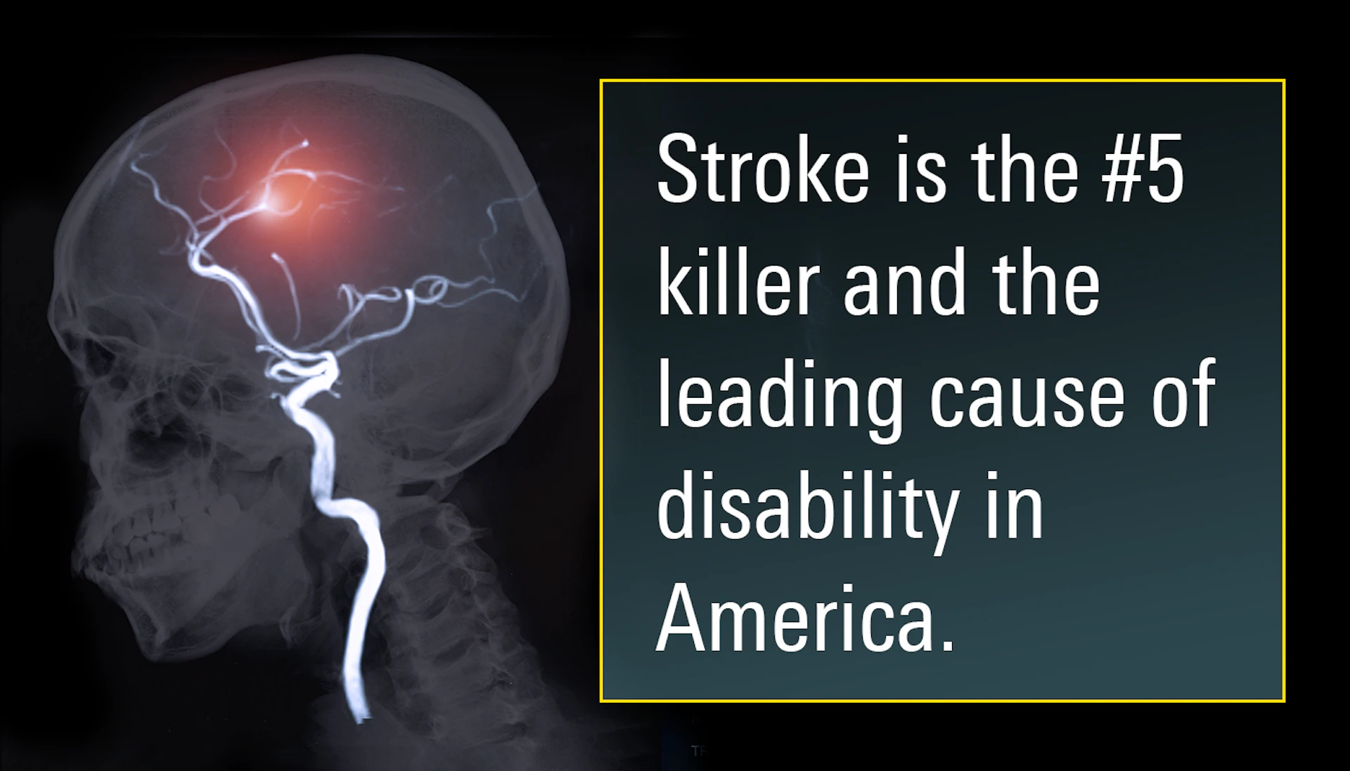 Stroke Hero