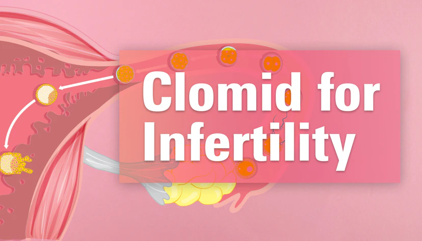 Clomid for infertility