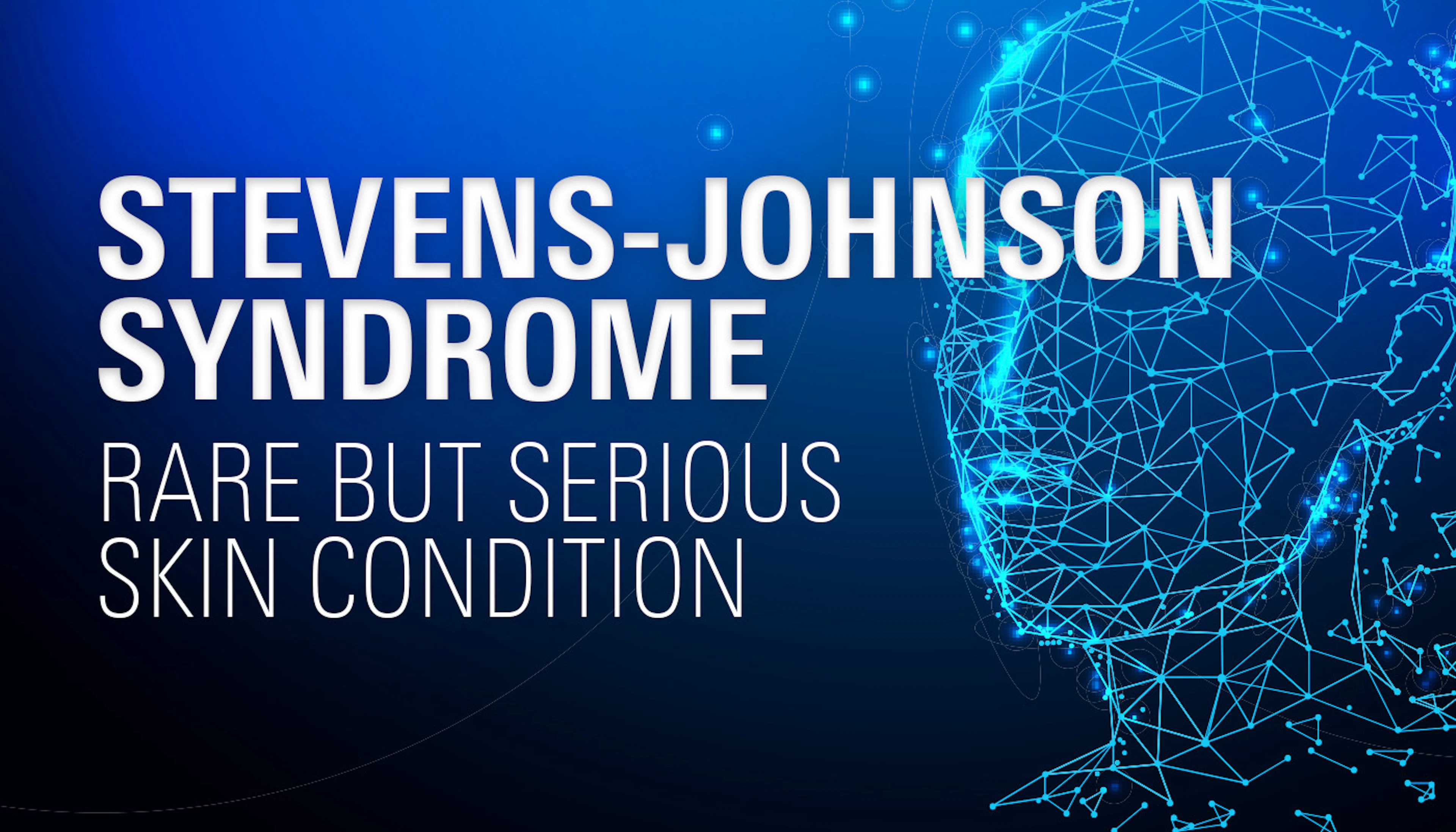 Stevens Johnson Syndrome
