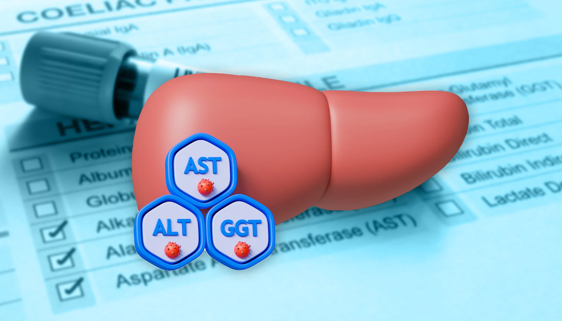 Liver Function Tests