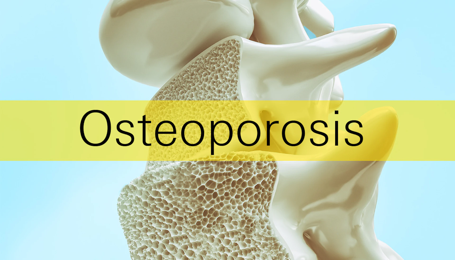 Bl Osteoporosis Hero