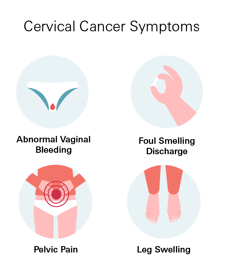 Cervical Cancer Symptoms